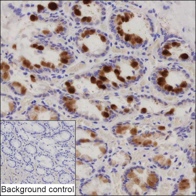 TFF2 Antibody in Immunohistochemistry (Paraffin) (IHC (P))