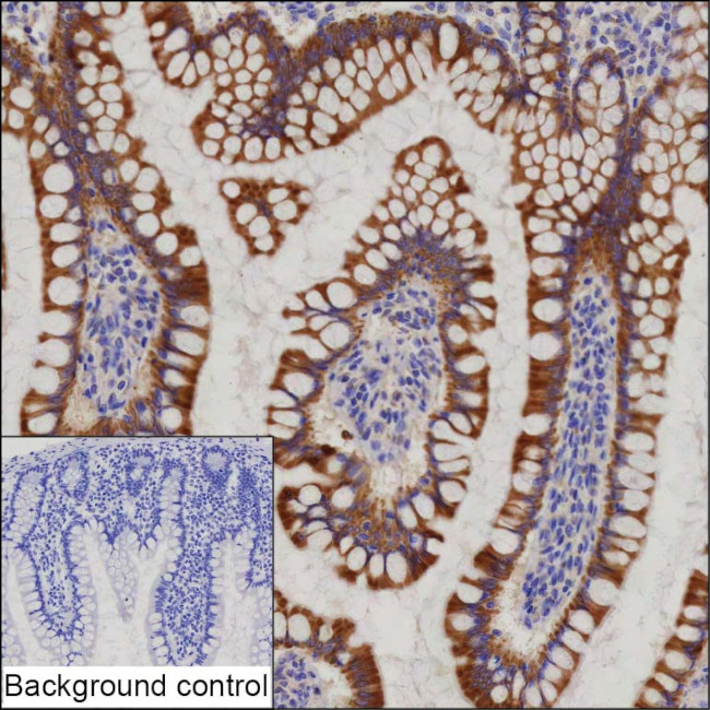 PRAP1 Antibody in Immunohistochemistry (Paraffin) (IHC (P))