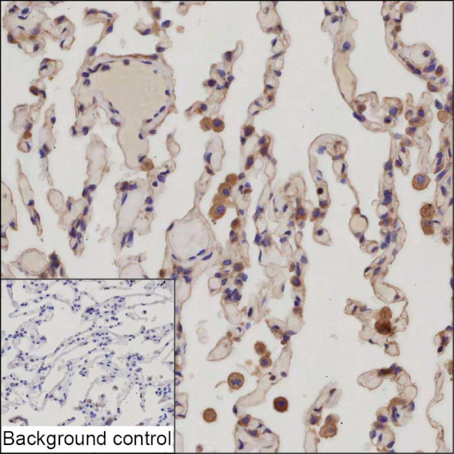 Interferon alpha-21 Antibody in Immunohistochemistry (Paraffin) (IHC (P))