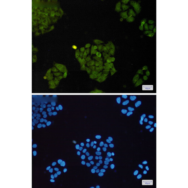 BAAT1 Antibody in Immunocytochemistry (ICC/IF)