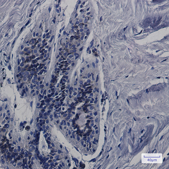 CDK5RAP3 Antibody in Immunohistochemistry (Paraffin) (IHC (P))