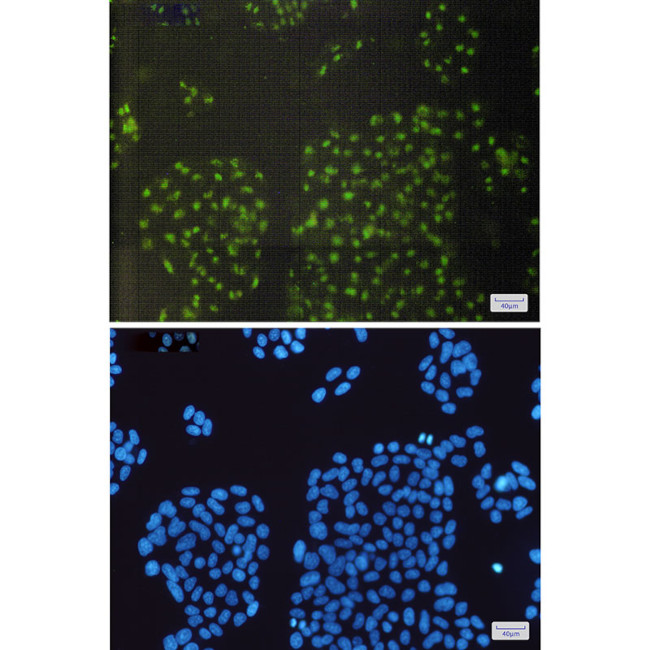 CRYAB Antibody in Immunocytochemistry (ICC/IF)