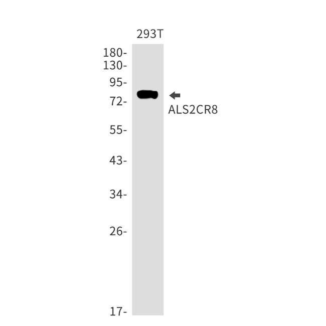 CARF Antibody in Western Blot (WB)