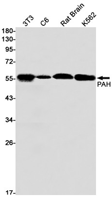 PAH Antibody in Western Blot (WB)