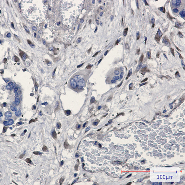 GNB2 Antibody in Immunohistochemistry (Paraffin) (IHC (P))