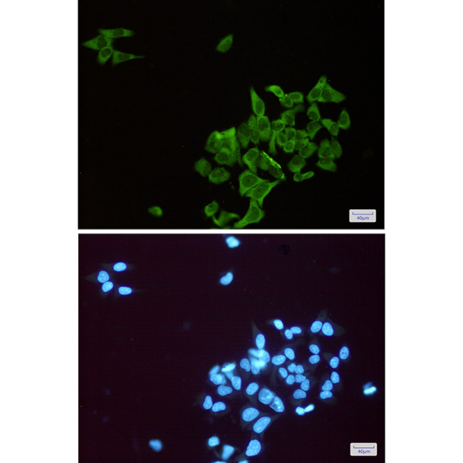 ENO1 Antibody in Immunocytochemistry (ICC/IF)