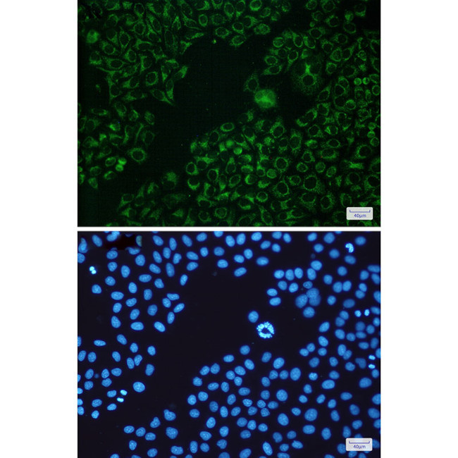 BAD Antibody in Immunocytochemistry (ICC/IF)