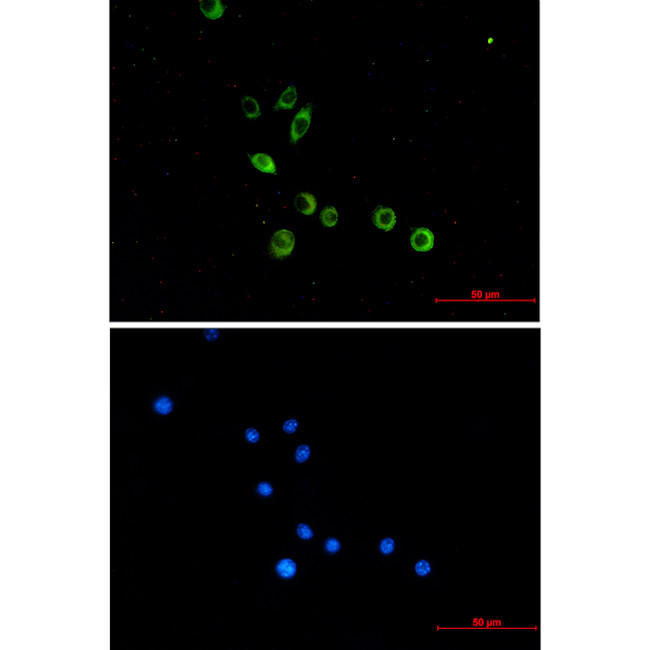 TLR2 Antibody in Immunocytochemistry (ICC/IF)