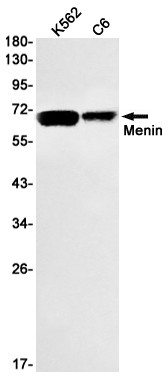 Menin Antibody in Western Blot (WB)