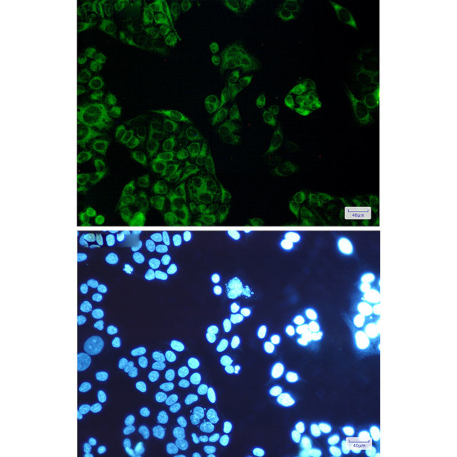 FDFT1 Antibody in Immunocytochemistry (ICC/IF)