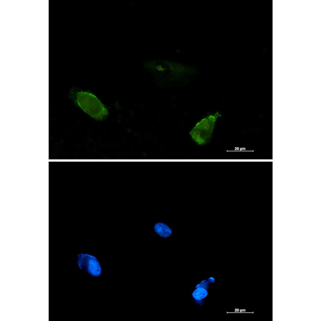 BIN1 Antibody in Immunocytochemistry (ICC/IF)