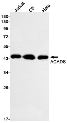 ACADS Antibody in Western Blot (WB)