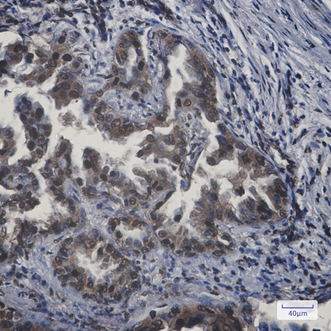 APPL1 Antibody in Immunohistochemistry (Paraffin) (IHC (P))