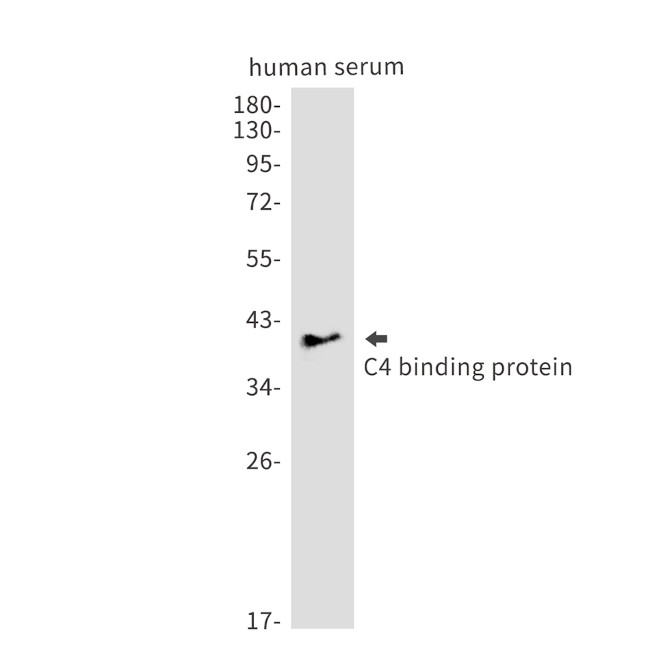 C4BPB Antibody in Western Blot (WB)
