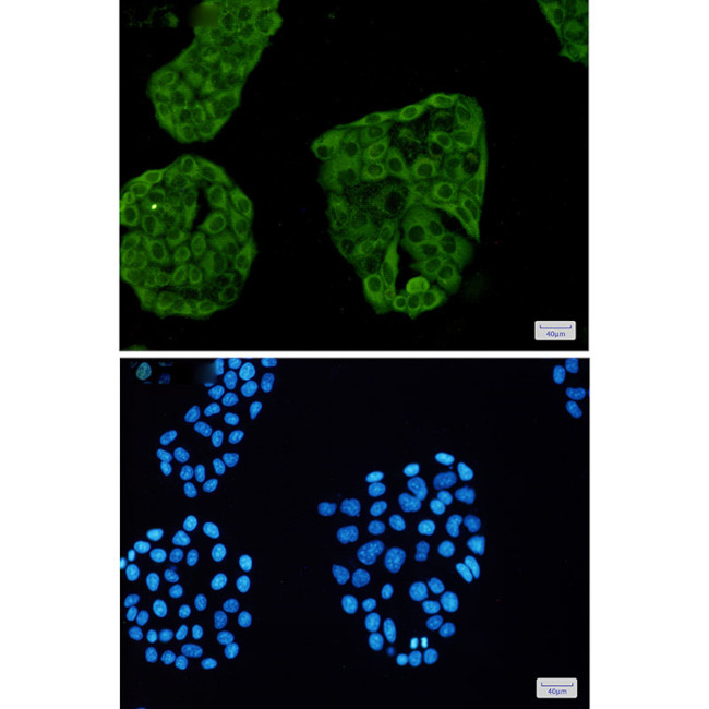 Annexin A6 Antibody in Immunocytochemistry (ICC/IF)