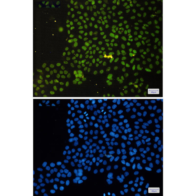ASH2L Antibody in Immunocytochemistry (ICC/IF)