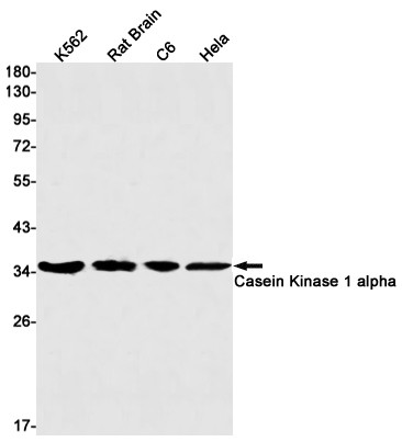 CK1 alpha Antibody in Western Blot (WB)