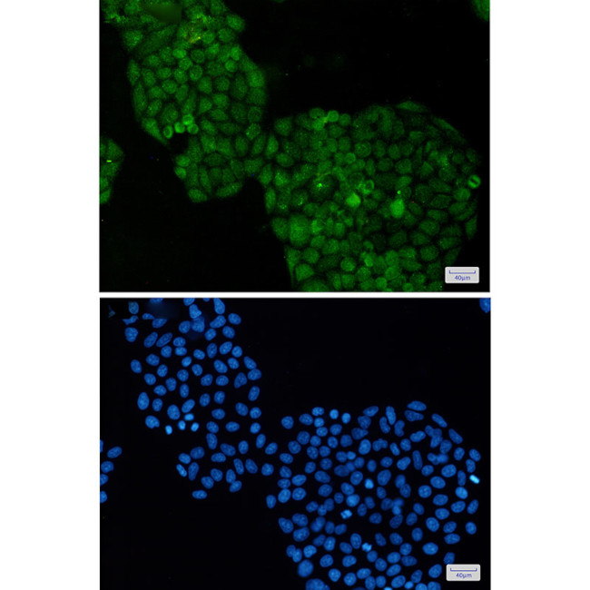 ADRM1 Antibody in Immunocytochemistry (ICC/IF)