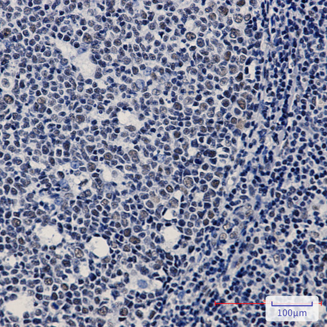 WTAP Antibody in Immunohistochemistry (Paraffin) (IHC (P))