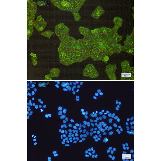 alpha Actinin 4 Antibody in Immunocytochemistry (ICC/IF)