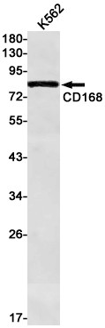 RHAMM Antibody in Western Blot (WB)