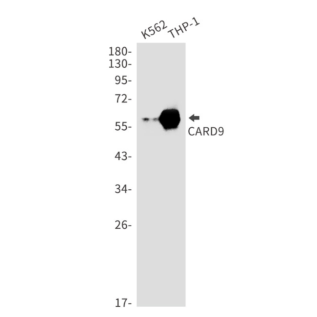 CARD9 Antibody in Western Blot (WB)