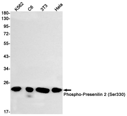 Phospho-PSEN2 (Ser330) Antibody in Western Blot (WB)