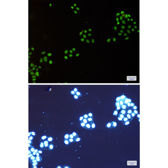 NAT10 Antibody in Immunocytochemistry (ICC/IF)