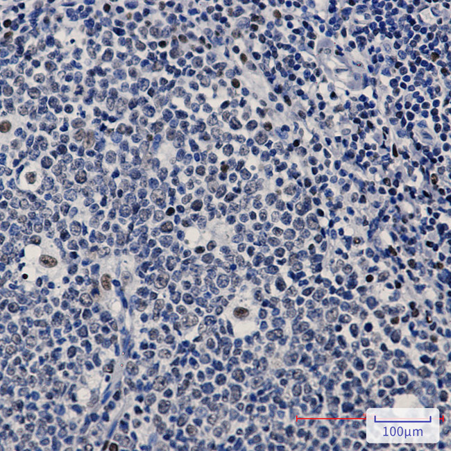 PREB Antibody in Immunohistochemistry (Paraffin) (IHC (P))