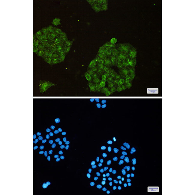 ARPC2 Antibody in Immunocytochemistry (ICC/IF)