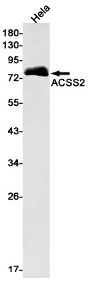 ACSS2 Antibody in Western Blot (WB)
