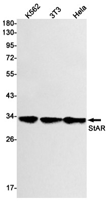 STAR Antibody in Western Blot (WB)
