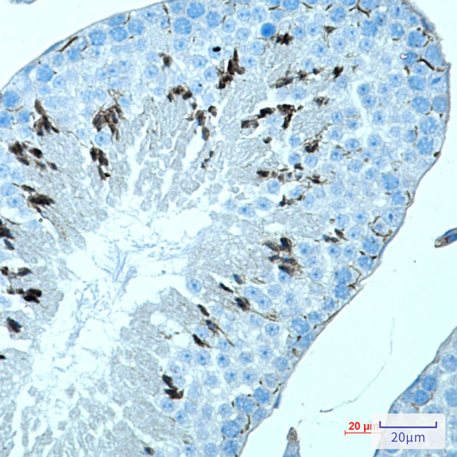 MAGEC2 Antibody in Immunohistochemistry (Paraffin) (IHC (P))