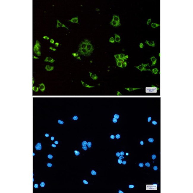 ATP5G1 Antibody in Immunocytochemistry (ICC/IF)