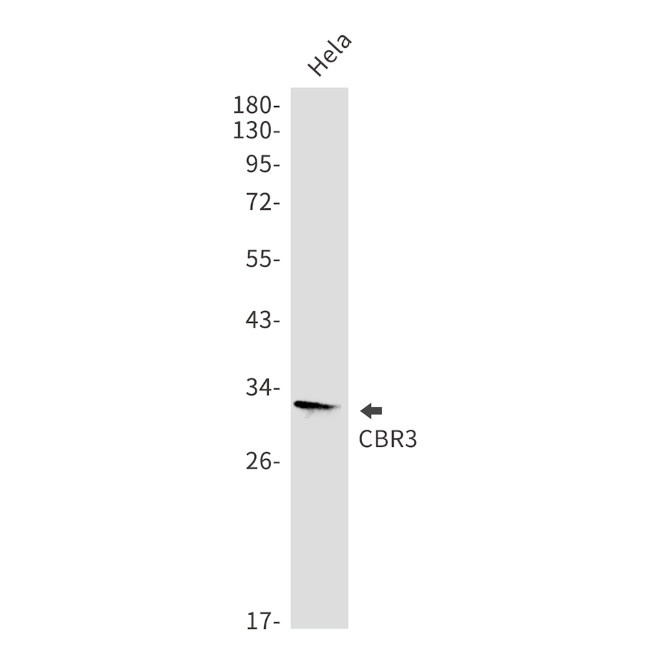 CBR3 Antibody in Western Blot (WB)