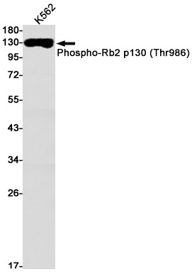Phospho-p130 (Thr986) Antibody in Western Blot (WB)
