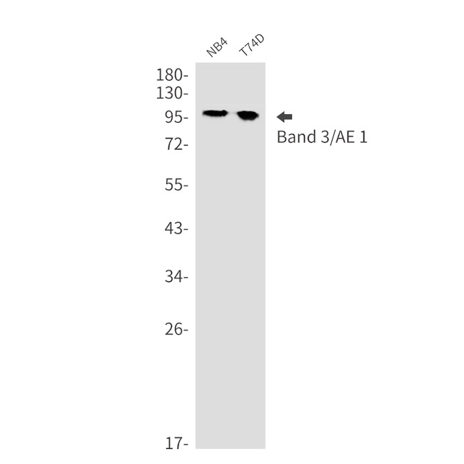 Band 3 Antibody in Western Blot (WB)