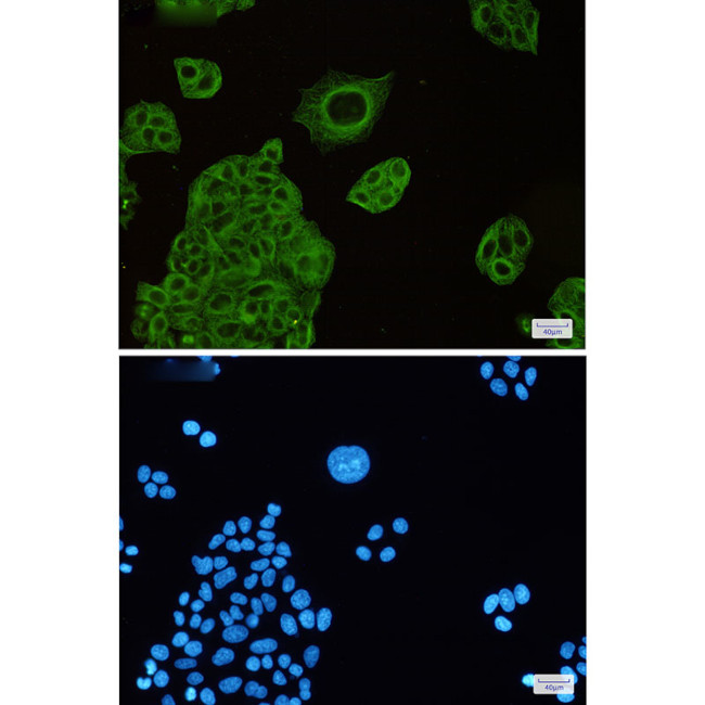 beta-4 Tubulin Antibody in Immunocytochemistry (ICC/IF)