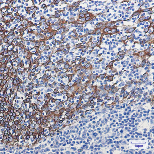 Cytokeratin 16 Antibody in Immunohistochemistry (Paraffin) (IHC (P))
