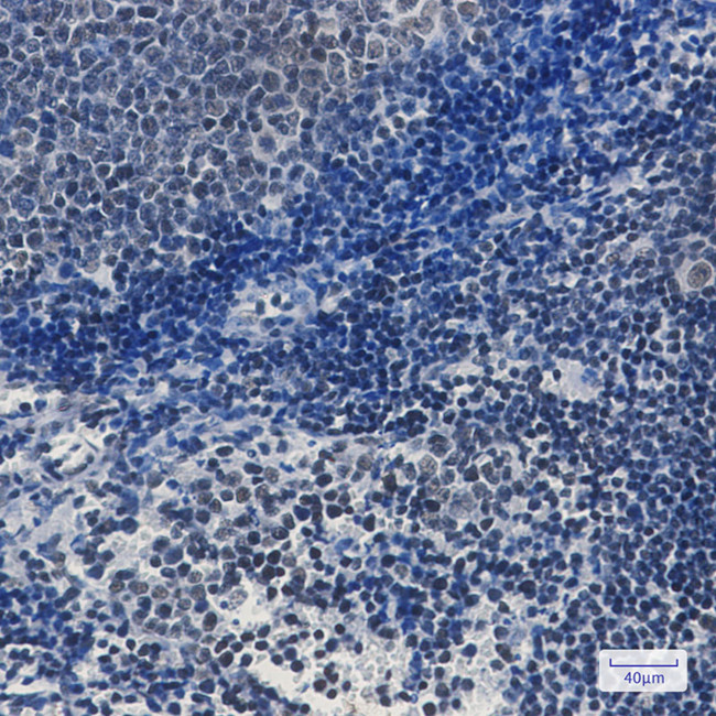 TAF3 Antibody in Immunohistochemistry (Paraffin) (IHC (P))