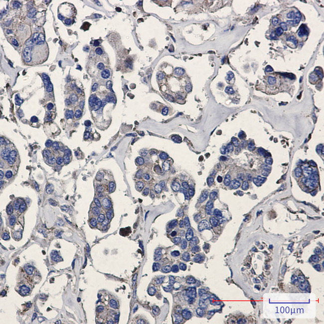ARPC5 Antibody in Immunohistochemistry (Paraffin) (IHC (P))