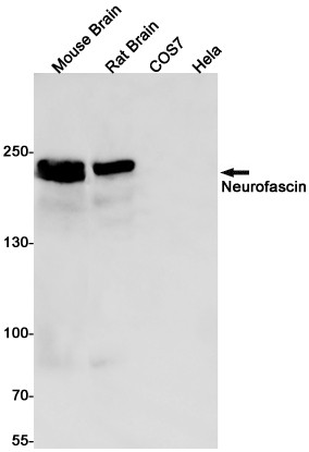 Neurofascin Antibody in Western Blot (WB)