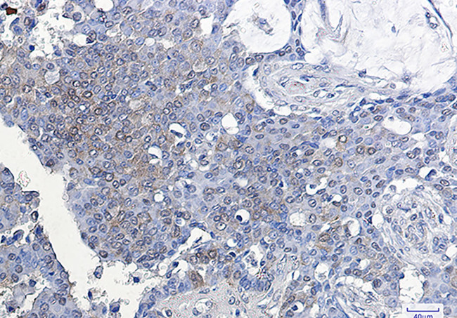 ATF5 Antibody in Immunohistochemistry (Paraffin) (IHC (P))