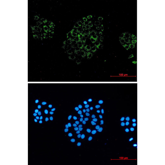 ACOX1 Antibody in Immunocytochemistry (ICC/IF)