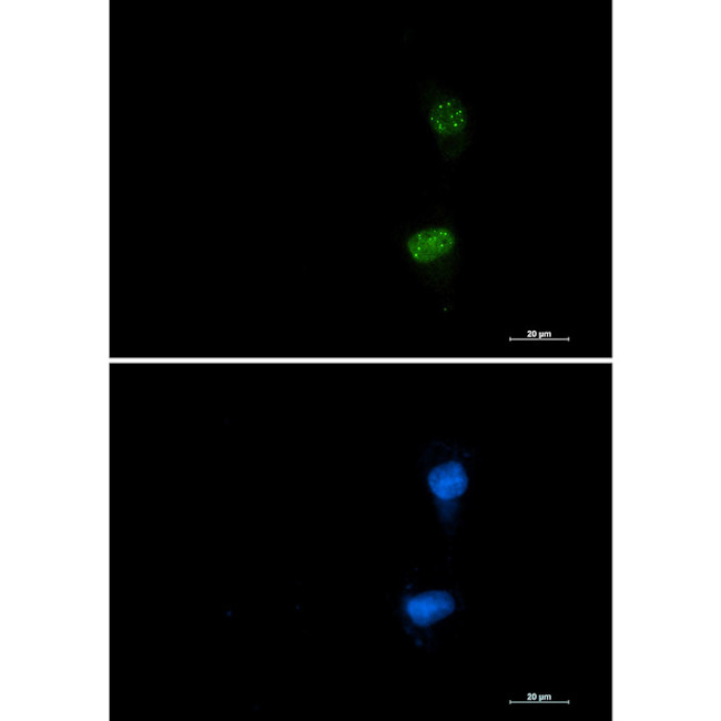 Phospho-ATF2 (Thr71) Antibody in Immunocytochemistry (ICC/IF)
