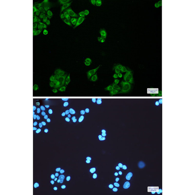 ELOVL5 Antibody in Immunocytochemistry (ICC/IF)