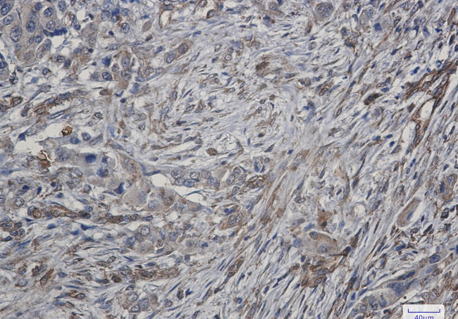 ATG4C Antibody in Immunohistochemistry (Paraffin) (IHC (P))