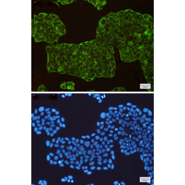 ASS1 Antibody in Immunocytochemistry (ICC/IF)
