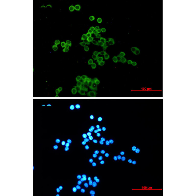 Desmocollin 3 Antibody in Immunocytochemistry (ICC/IF)