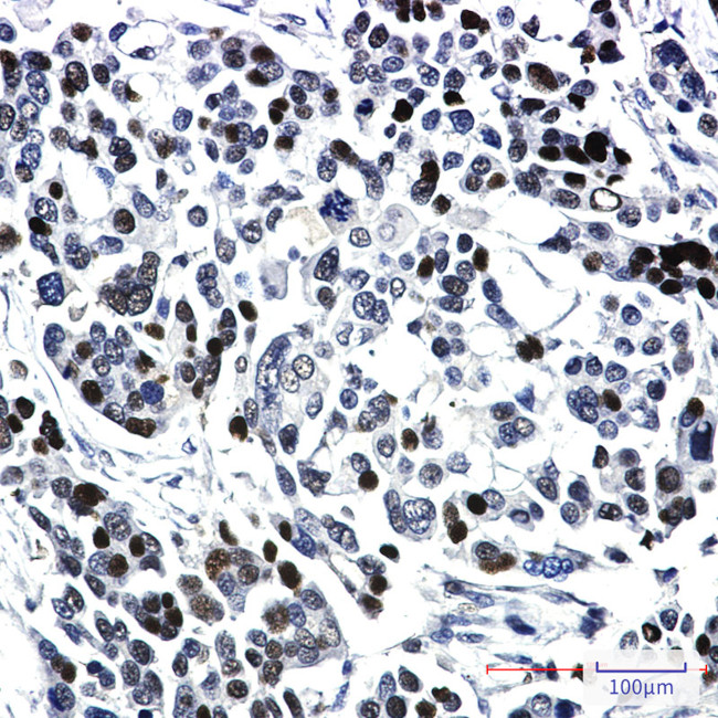 SRC1 Antibody in Immunohistochemistry (Paraffin) (IHC (P))